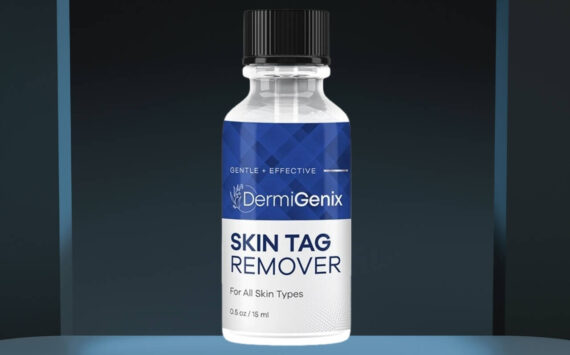 DermiGenix Skin Tag Remover: Is It Really Safe and Effective for All Skin  Types? | Mercer Island Reporter